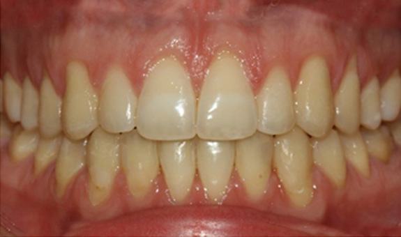 Harwood Dental Care Bolton | Dentist Bolton