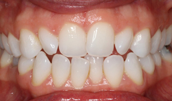 Harwood Dental Care Bolton | Dentist Bolton