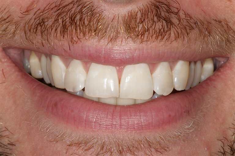 Harwood Dental Care Bolton | Dentist Bolton