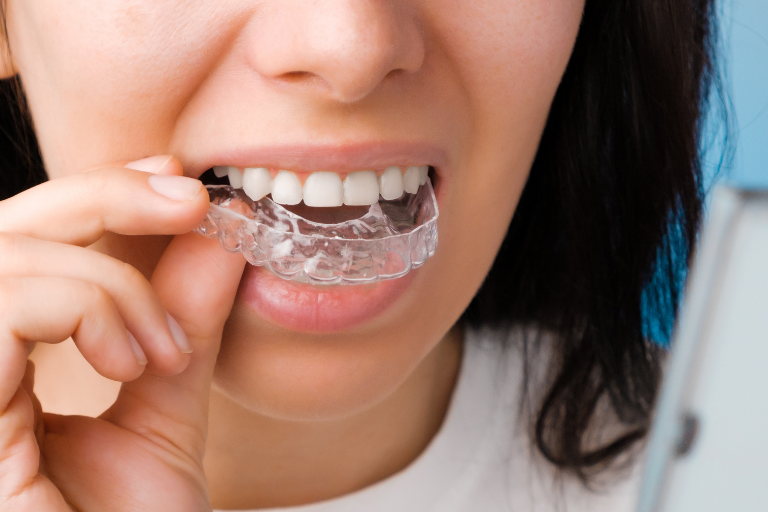 Woman putting in Invisalign braces at Harwood Dental Practice in Bolton, Harwood
