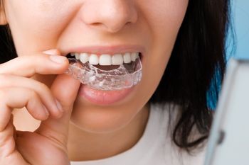 10 Facts About Invisalign Braces