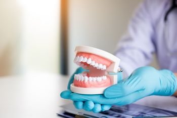 Do Dental Implants Feel Natural?