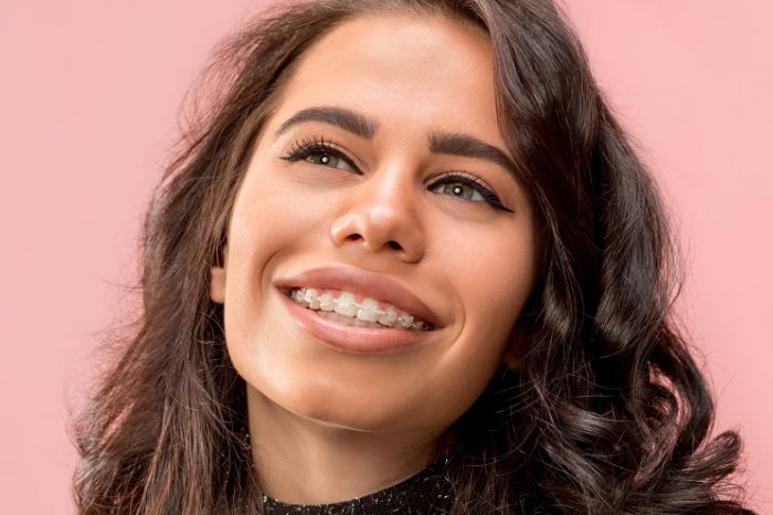 Everything You Need to Know About Getting Braces