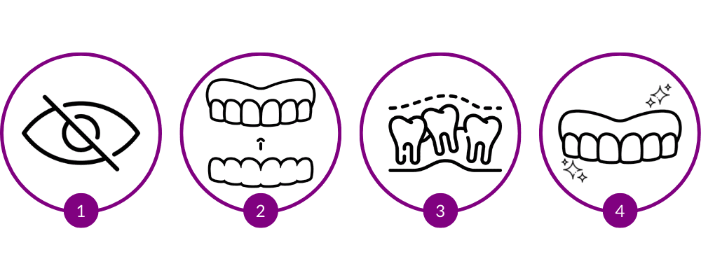 Invisalign clear aligners