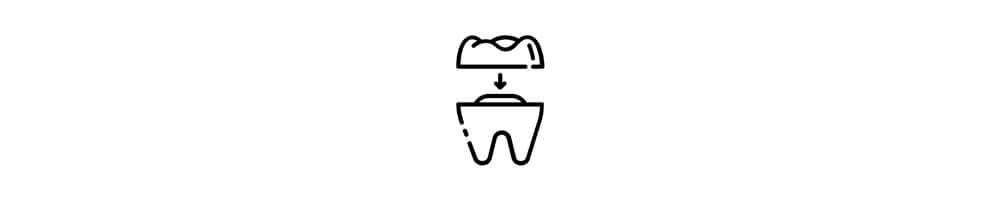 Dental crowns and bridges