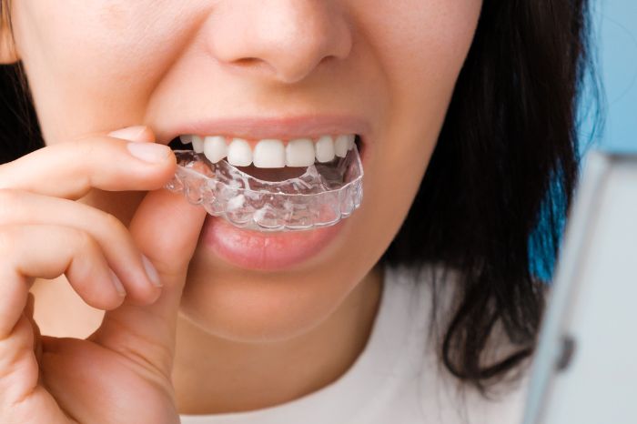 Woman with Invisalign braces - Harwood Dental Care - Harwood, Bolton