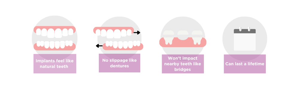 Implants feel like natural teeth 
No slippage like dentures 
Won't impact nearby teeth like bridges 
Can last a lifetime 