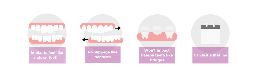 Dental implants benefits - Harwood Dental Care - Harwood, Bolton