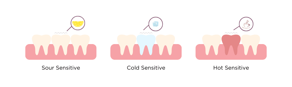 sensitive teeth - Harwood Dental Care - Harwood, bolton