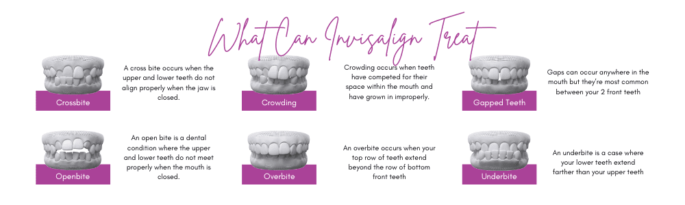 what can invisalign treat - Harwood Dental - Harwood, Bolton