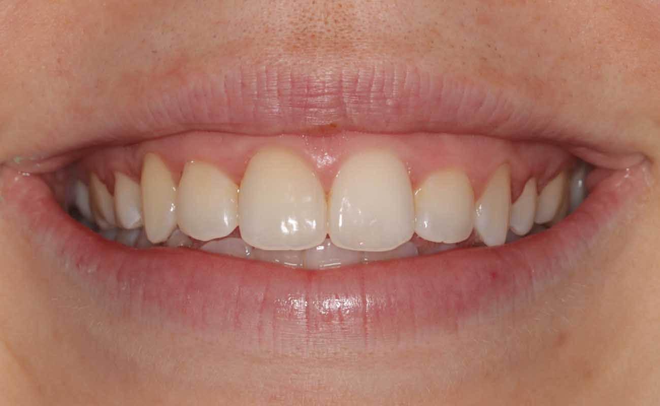 Treatment After Image Reading | Aspire Clinic