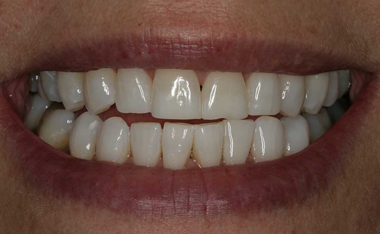 Treatment After Image Reading | Aspire Clinic