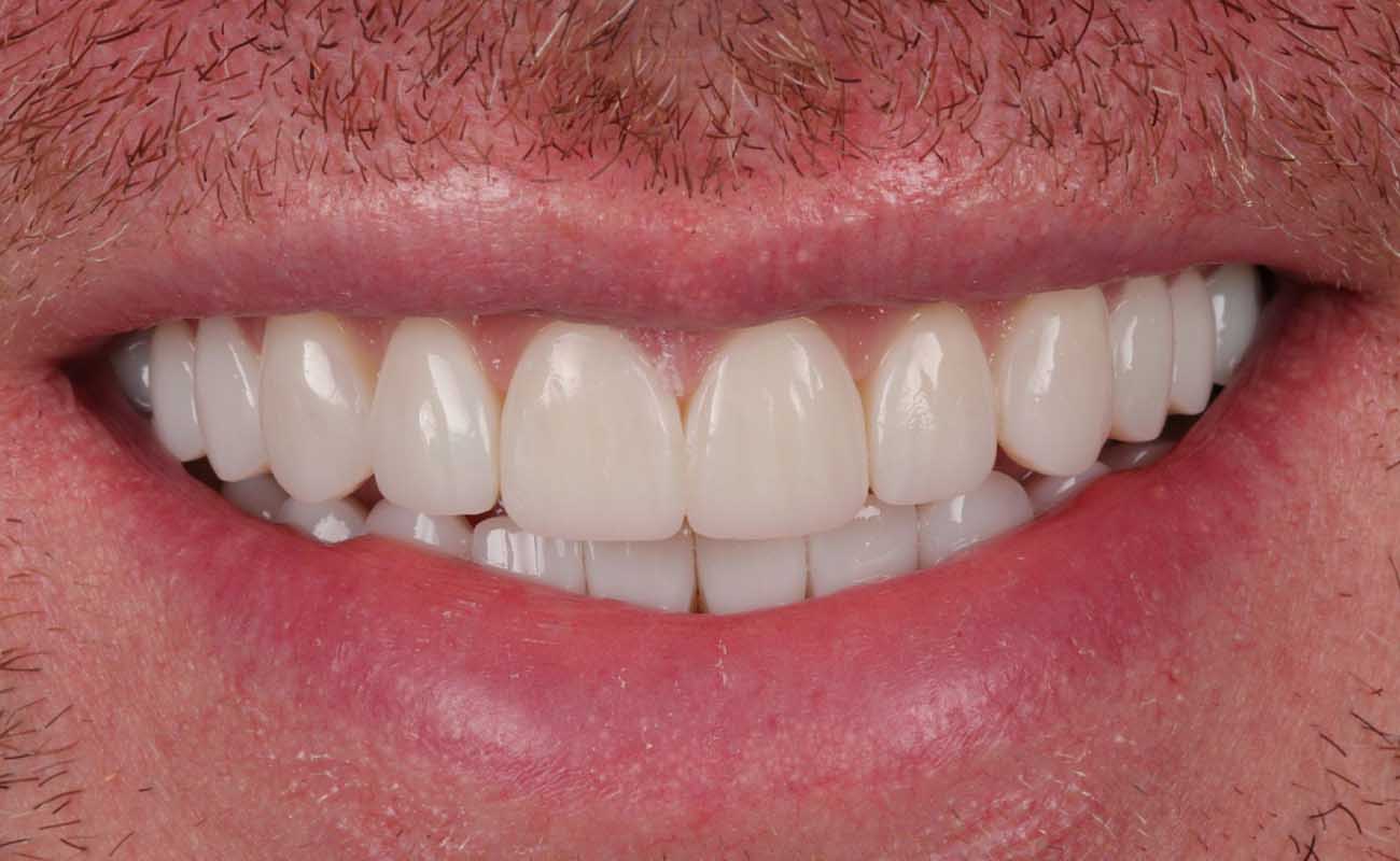 Treatment After Image Reading | Aspire Clinic