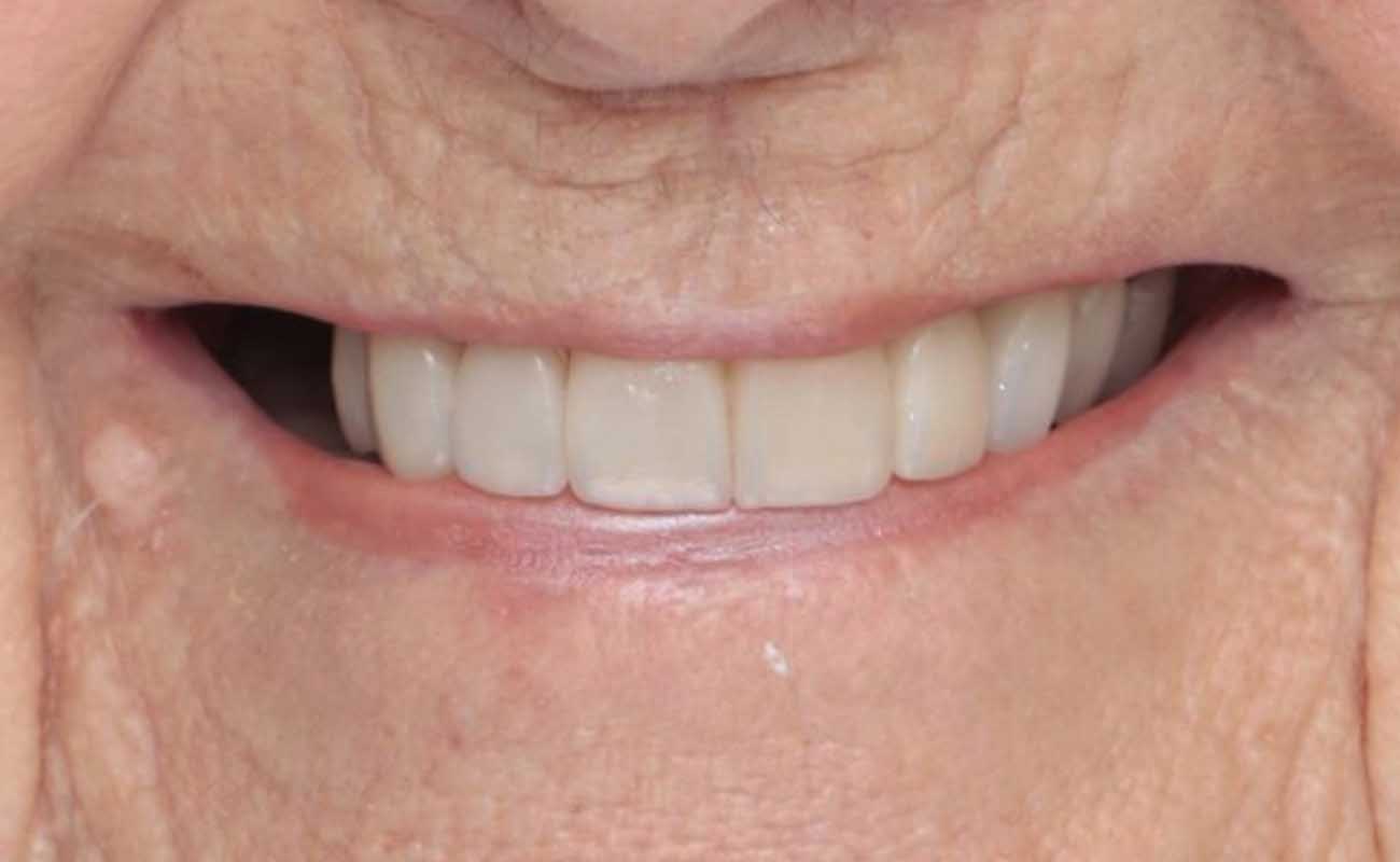 Treatment After Image Reading | Aspire Clinic
