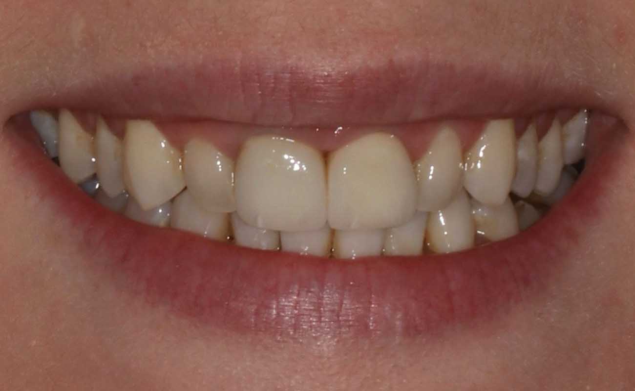 Treatment After Image Reading | Aspire Clinic
