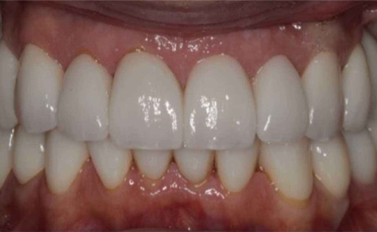 Treatment After Image Reading | Aspire Clinic