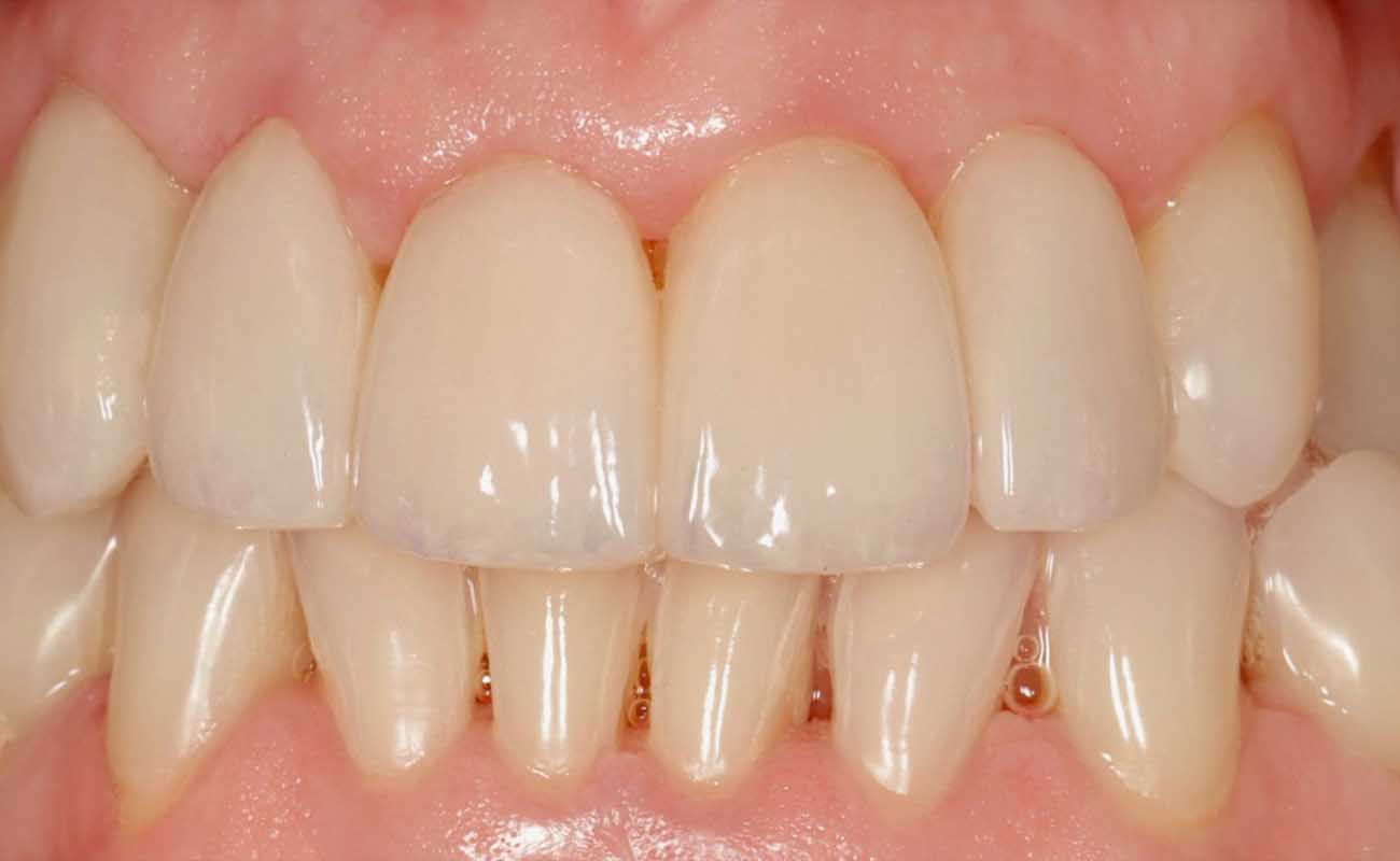 Treatment After Image Reading | Aspire Clinic