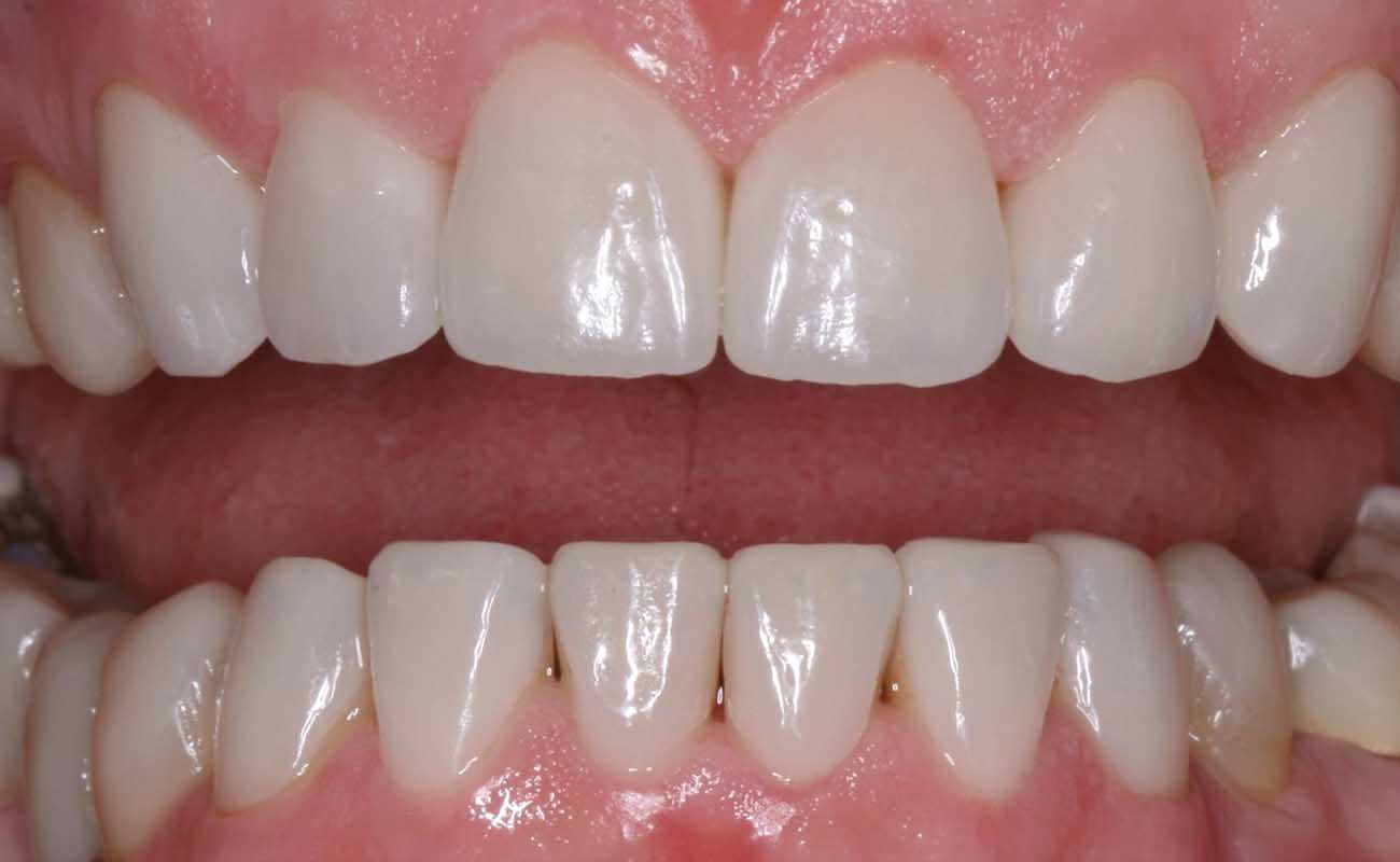 Treatment After Image Reading | Aspire Clinic