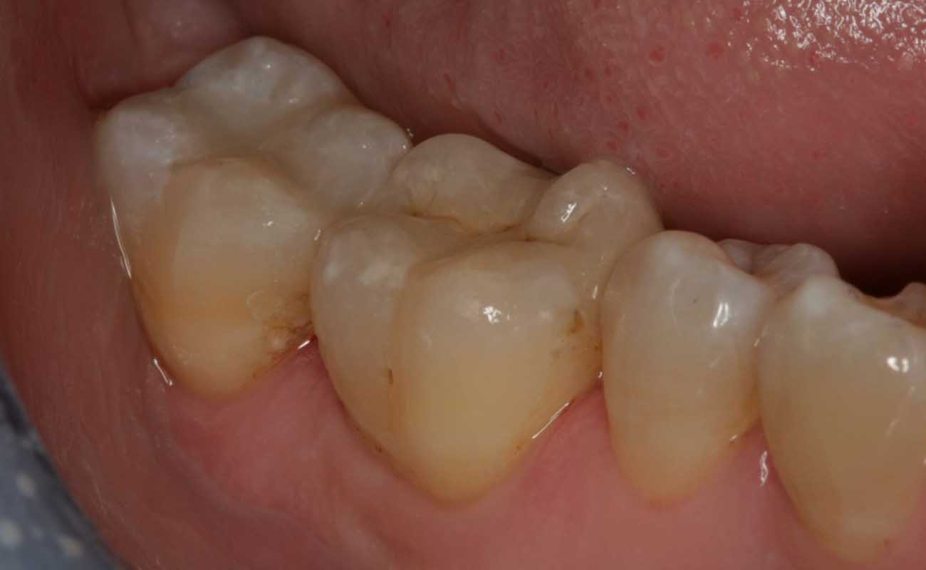 Treatment After Image Reading | Aspire Clinic