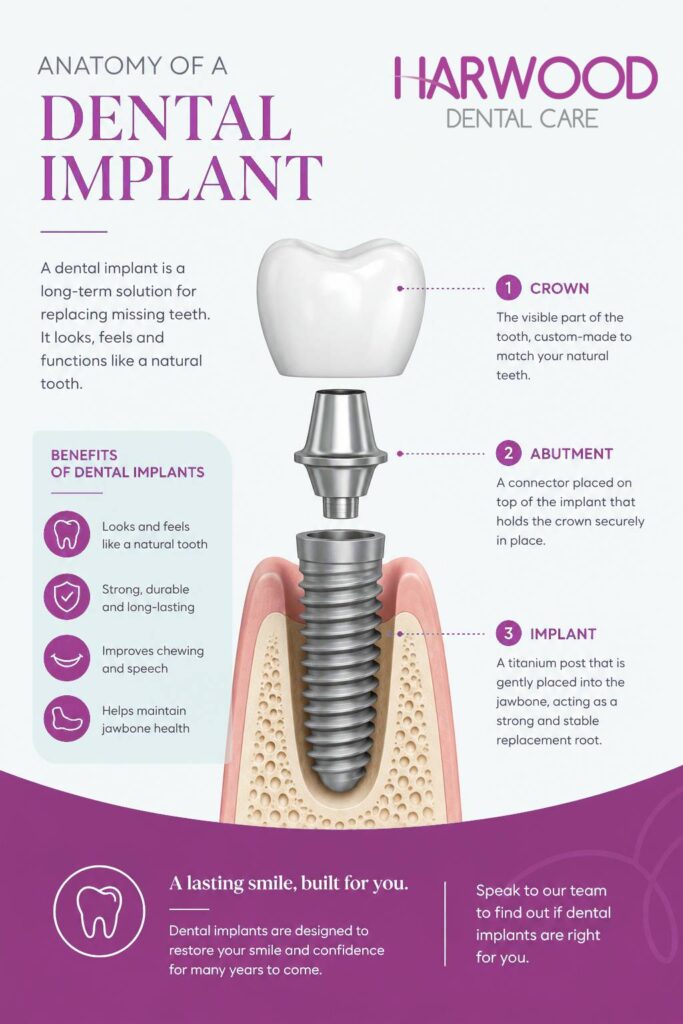 An infographic which shows the anatomy of a dental implant